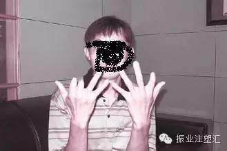 安全第一 細(xì)數(shù)注塑行業(yè)那些安全事故 安全第一 細(xì)數(shù)注塑行業(yè)那些安全事故