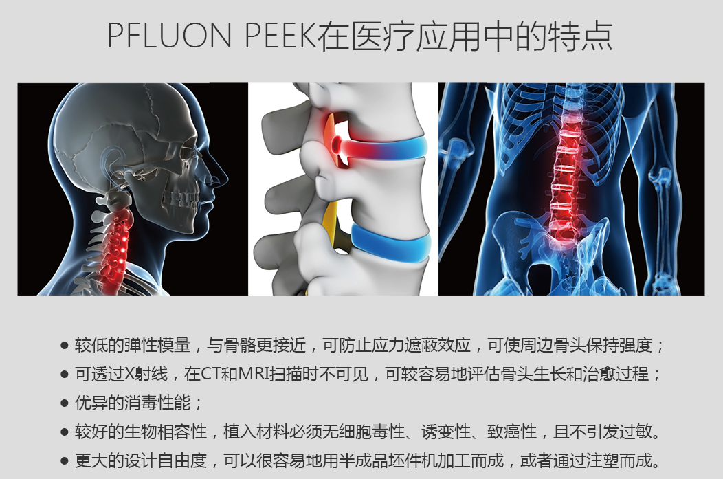 医用级PEEK生产制造10家企业介绍