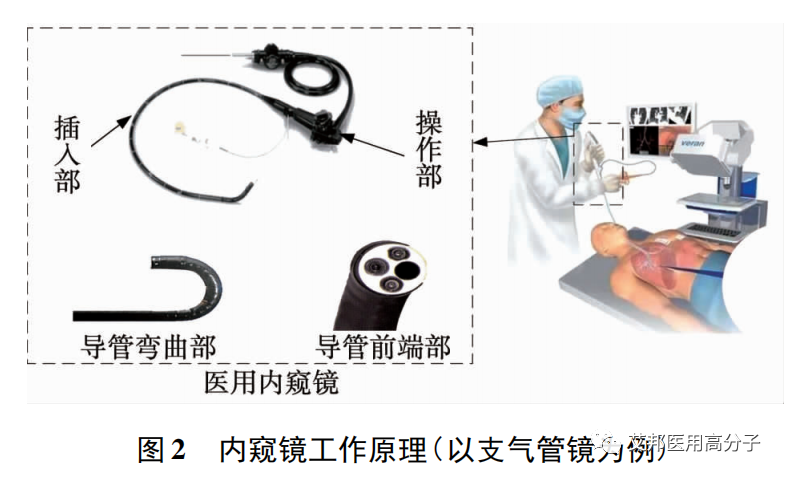 醫用內窺鏡裝置的研究進展之機械結構
