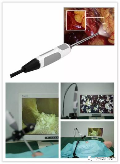 醫用內窺鏡裝置的研究進展之機械結構