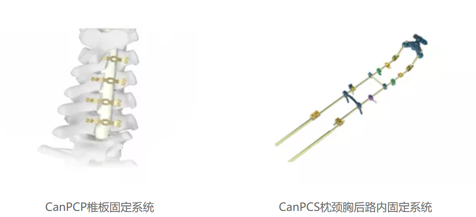 骨科植入成PEEK高端应用市场， 20家骨科植入相关公司介绍