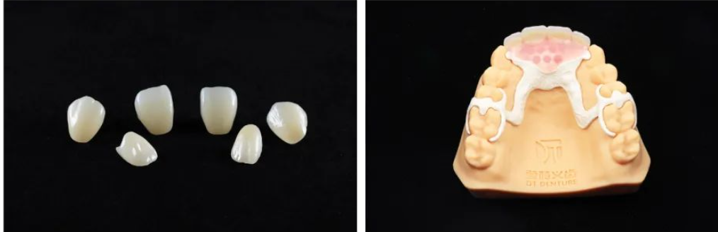 3D打印PEEK及復合材料在口腔醫(yī)學領(lǐng)域的研究進展 3D打印PEEK及復合材料在口腔醫(yī)學領(lǐng)域的研究進展