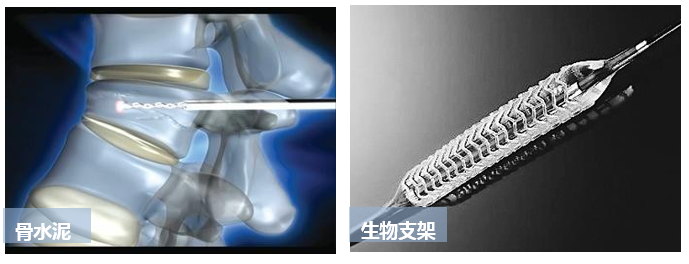 建议收藏|生物医用陶瓷材料的应用