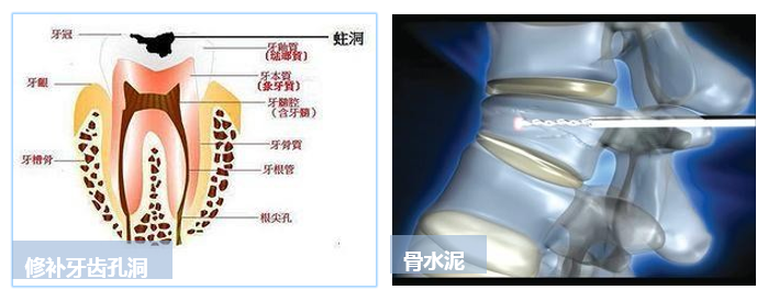 建议收藏|生物医用陶瓷材料的应用