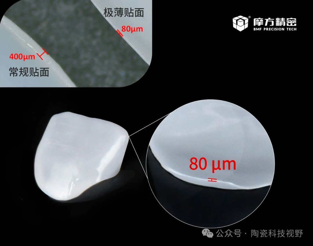 全瓷牙齿贴面用陶瓷材料介绍